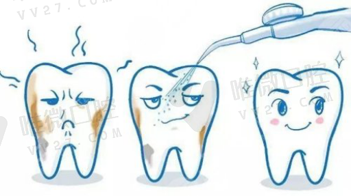 固定义齿和活动假牙的区别,活动义齿与固定义齿和种植牙的区别(图1)